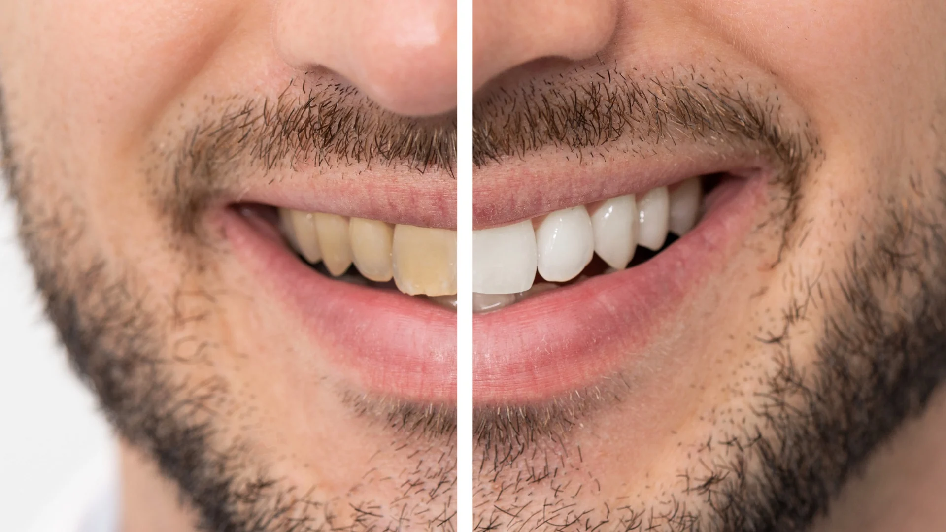 Split-screen smile imagery from Columbia Dental’s published website