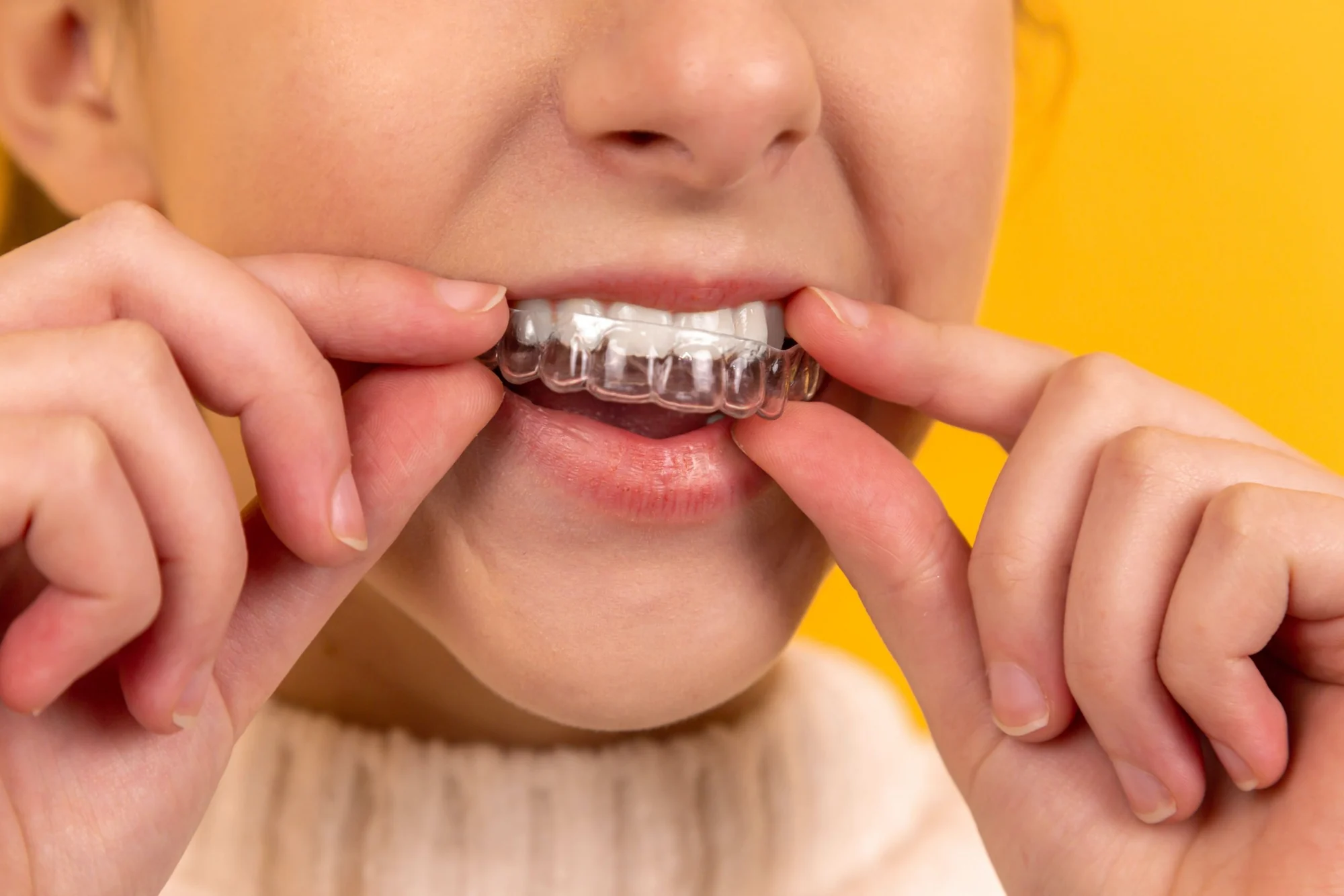 A patient placing a clear aligner over their teeth